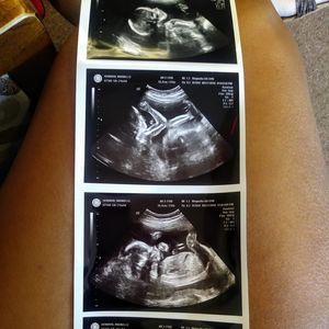 Meet your Posher, Dawn